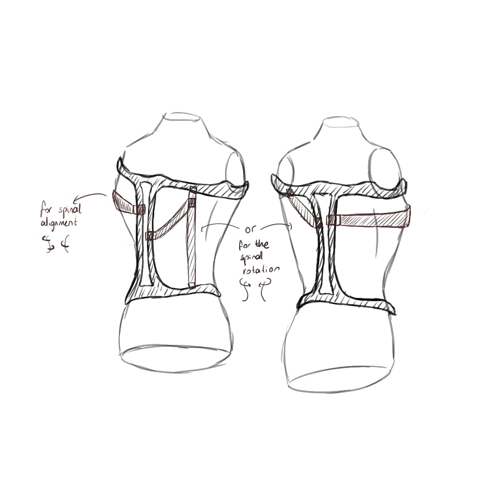 Brace Design